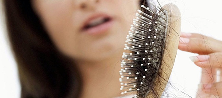 caida del cabello alopecia femenina